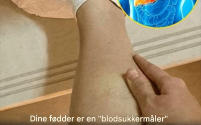 Dine fødder er en “blodsukkermåler” – Pas på diabetes, hvis du ofte oplever disse 12 symptomer