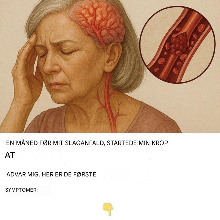 En måned før mit slagtilfælde begyndte min krop at advare mig. Dette var de første symptomer.