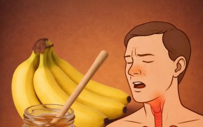 Bland bananer, honning og vand: Hoste og bronkitis vil forsvinde