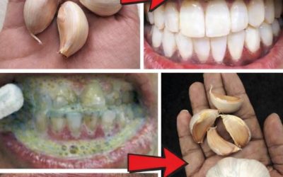 Opdag de naturlige fordele ved hvidløg for et sundere smil