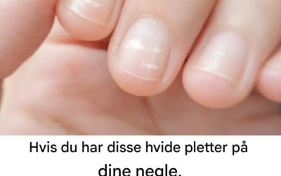 Hvorfor ser vi nogle gange hvide pletter på vores negle?