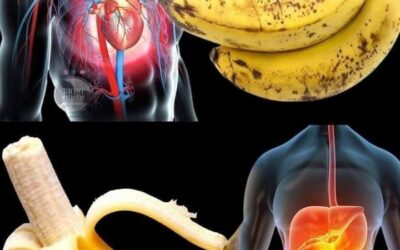 Grøn, gul eller overmoden banan: hvilken er bedst for dit helbred?