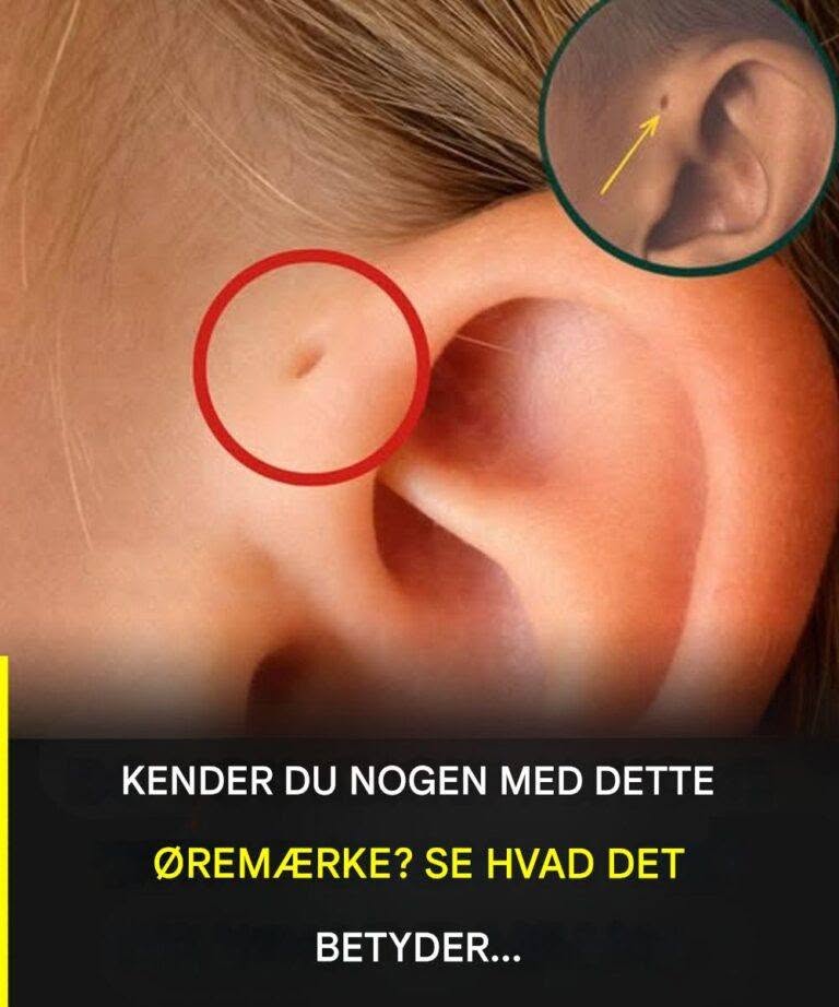 Oplev betydningen af dette særlige mærke på øret.