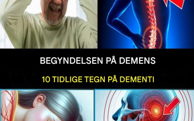 7 tidlige tegn på Alzheimers sygdom, du aldrig bør ignorere!