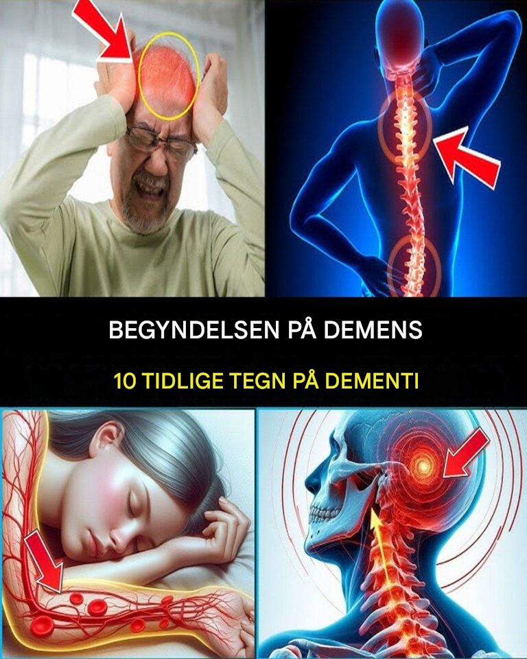 7 tidlige tegn på Alzheimers sygdom, du aldrig bør ignorere!