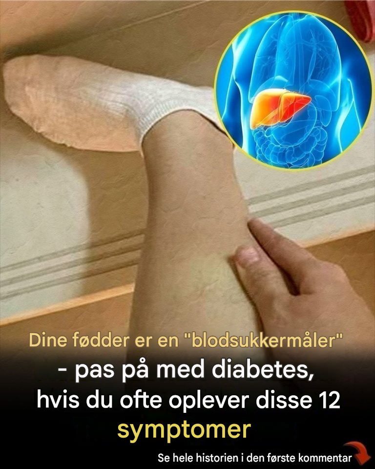 Dine fødder er en "blodsukkermåler" – pas på med diabetes, hvis du ofte oplever disse 12 symptomer