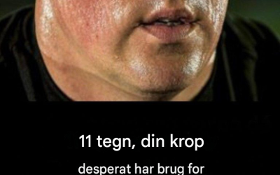 11 tegn på, at din krop desperat har brug for D-vitamin
