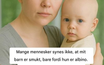 Siden jeg fik mit barn, har jeg indset, at verden ikke altid er klar til at se skønhed, der er anderledes end normen. Nogle mennesker ser på hende og smiler. Andre ser væk.