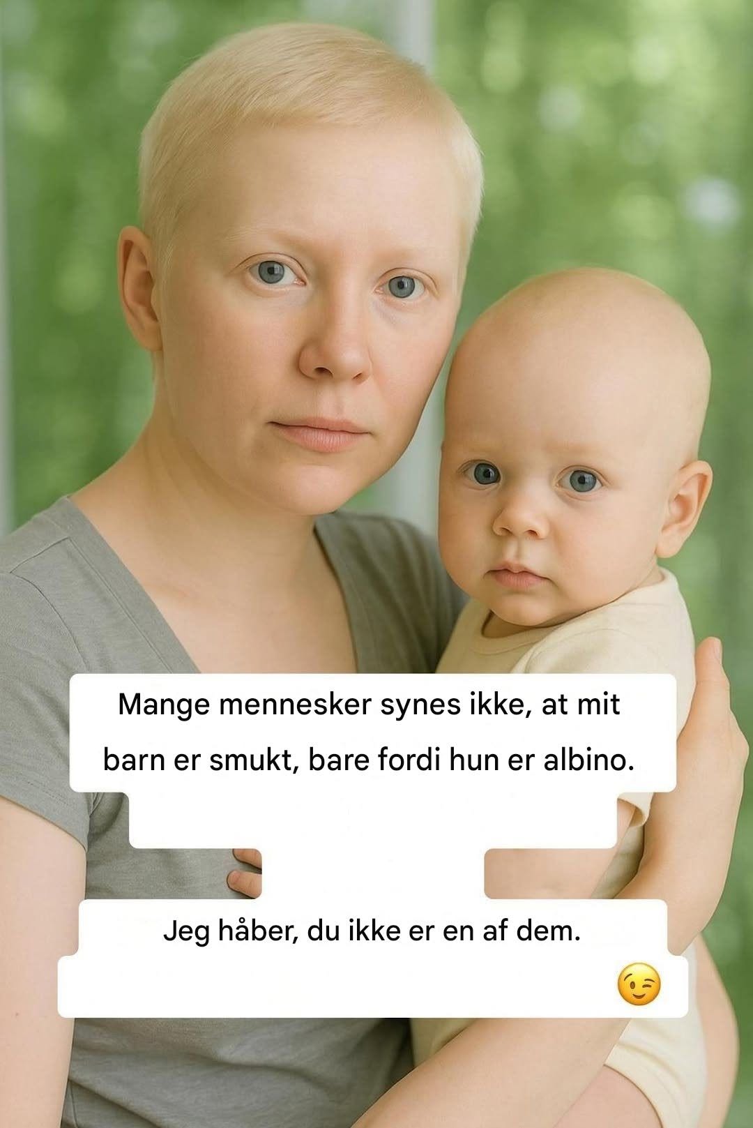 Siden jeg fik mit barn, har jeg indset, at verden ikke altid er klar til at se skønhed, der er anderledes end normen. Nogle mennesker ser på hende og smiler. Andre ser væk.