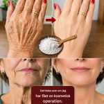 “Det ser ud som om, jeg har fået foretaget plastikkirurgi”: Husråd til at forbedre rynker og mørke pletter på hænder og arme. For at blive ved med at modtage mine opskrifter, skal du bare sige … Tak!