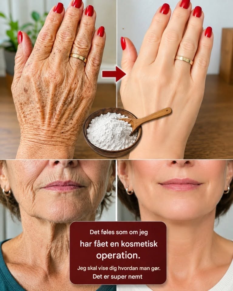 “Det ser ud som om, jeg har fået foretaget plastikkirurgi”: Husråd til at forbedre rynker og mørke pletter på hænder og arme. For at blive ved med at modtage mine opskrifter, skal du bare sige … Tak!