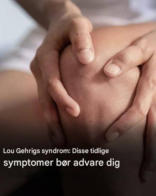 Lou Gehrigs syndrom: Her er de første symptomer på denne sygdom