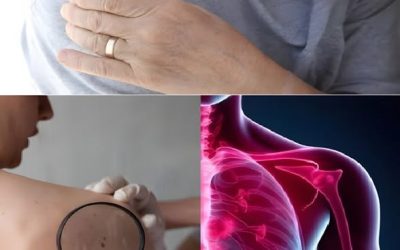 16 tidlige tegn på, at kræft vokser i din krop