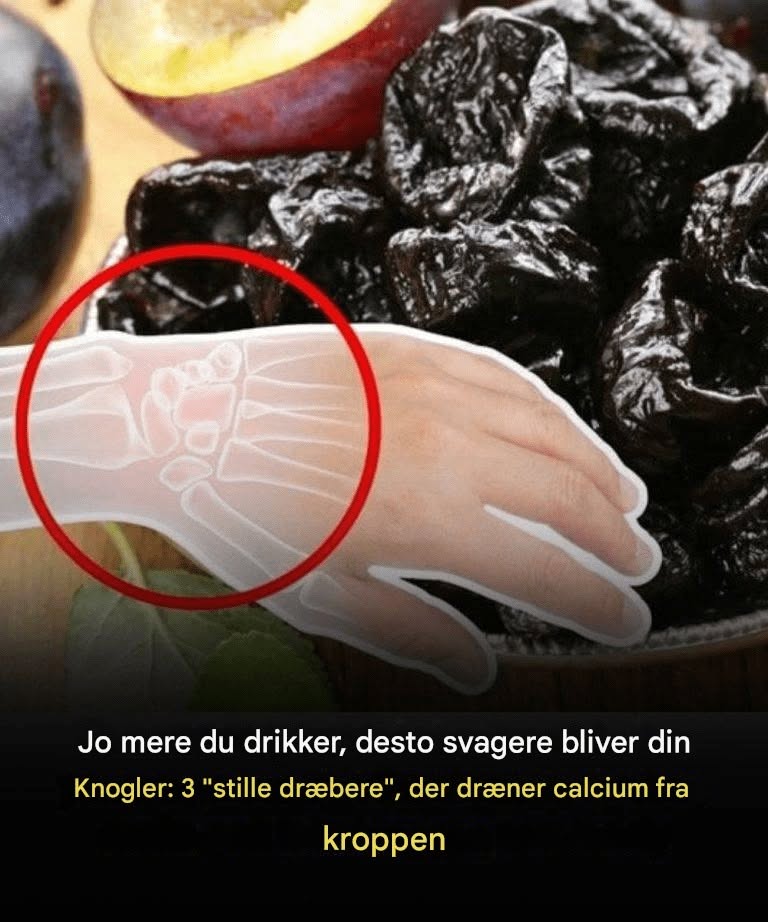 Jo mere du spiser, jo mere svækkes dine knogler: 3 “stille dræbere”, der berøver din krop for calcium