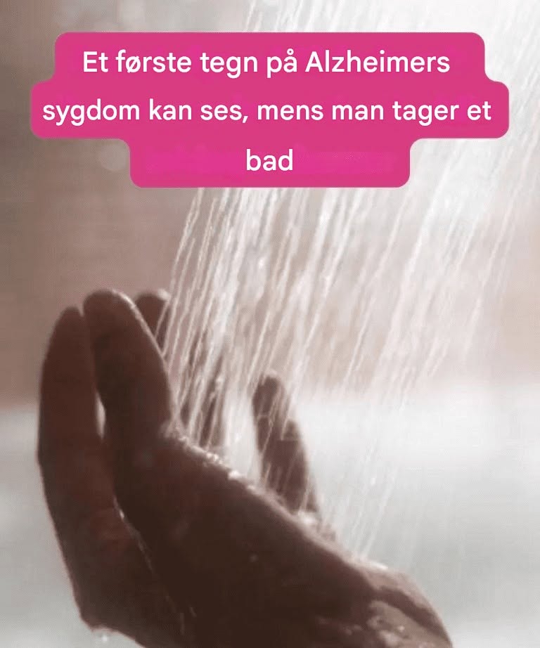 Et tidligt tegn på Alzheimers sygdom kan ses, mens man tager et bad: hvad skal man være opmærksom på?