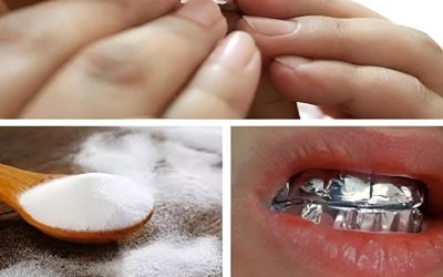 Sådan bleger du tænder med salt og hvidløg