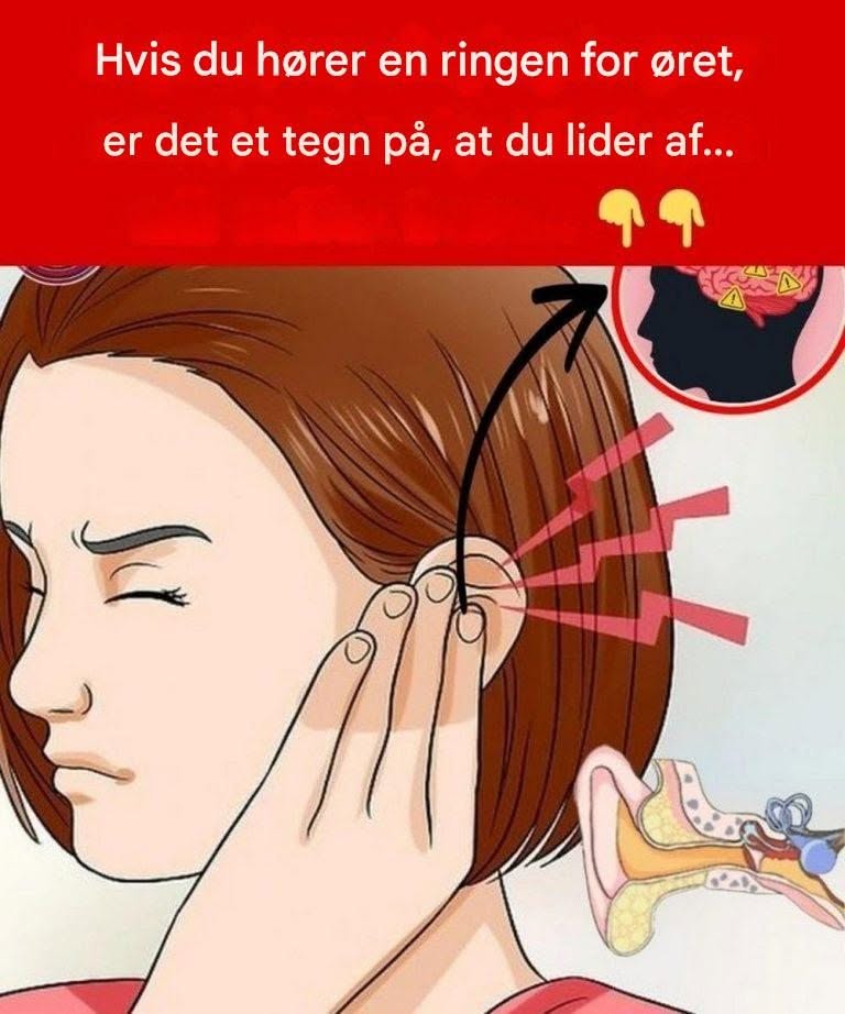 Hvis du hører en ringen for øret, er det et tegn på, at du lider af…