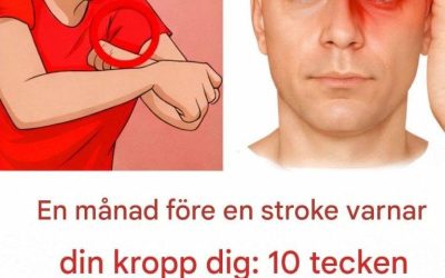 En måned før et slagtilfælde advarer din krop dig: 10 tegn, du ikke skal ignorere