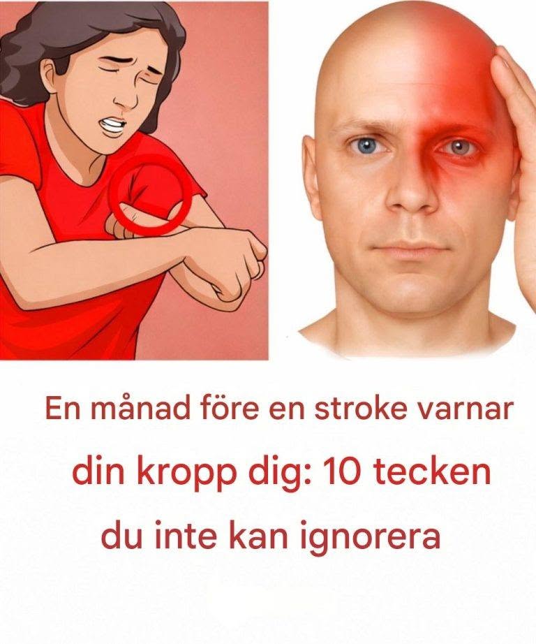 En måned før et slagtilfælde advarer din krop dig: 10 tegn, du ikke skal ignorere