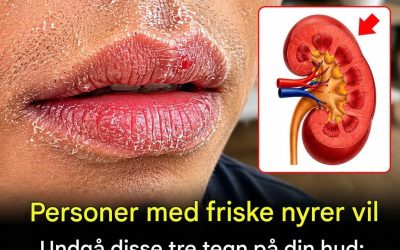 Sunde nyrer er ofte synlige gennem huden: 3 tegn du bør kende