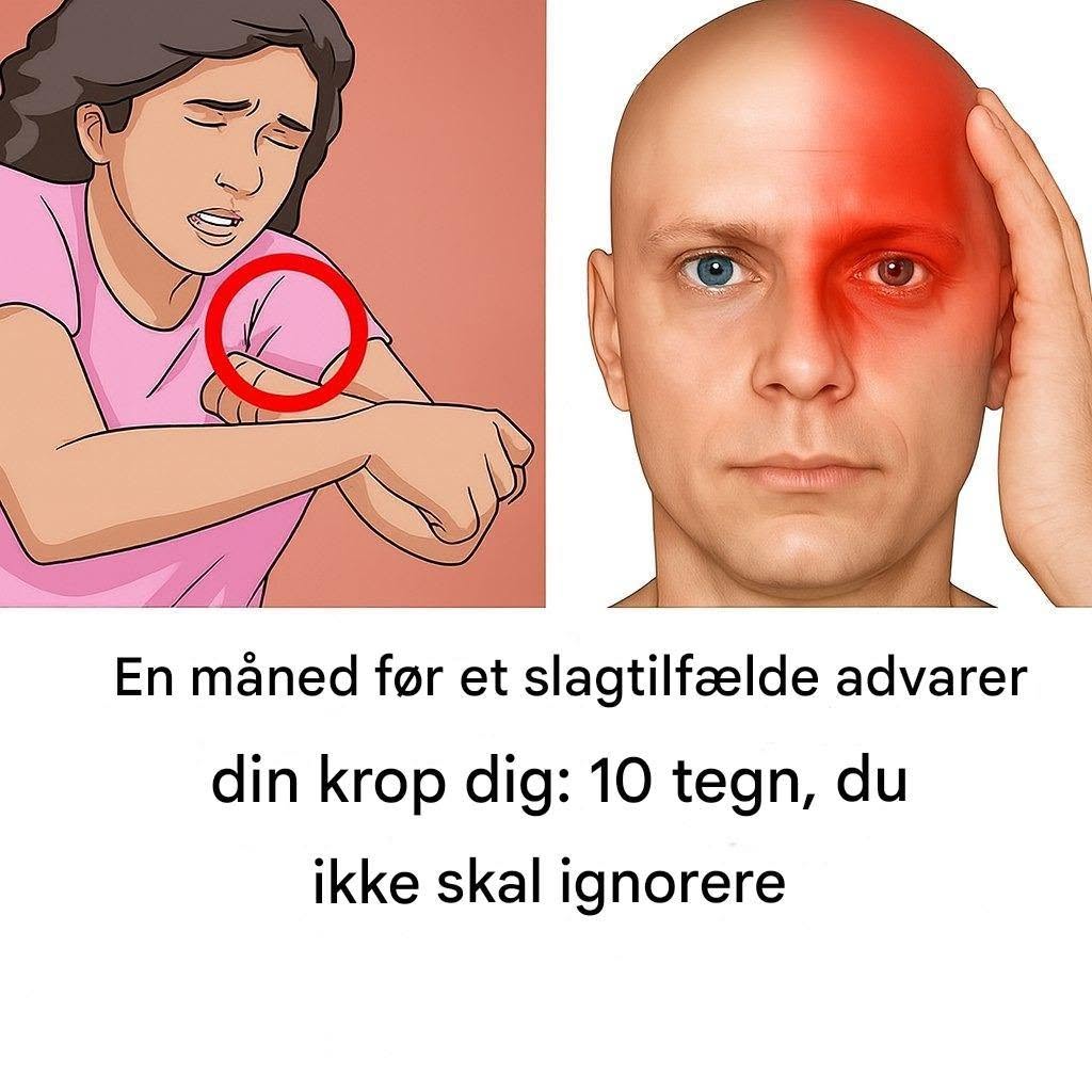 En måned før et slagtilfælde advarer din krop dig: 10 tegn, du ikke skal ignorere